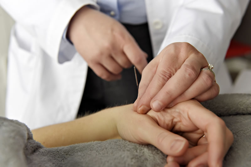 services-acupuncture1