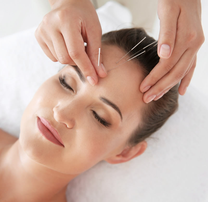 services-ca-1 Facial acupuncture