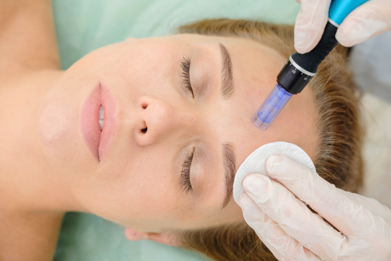 Cosmetologist,Making,Mesotherapy,Injection.,Microneedle,Mesotherapy.,Treatment,Woman,At,Beautician.