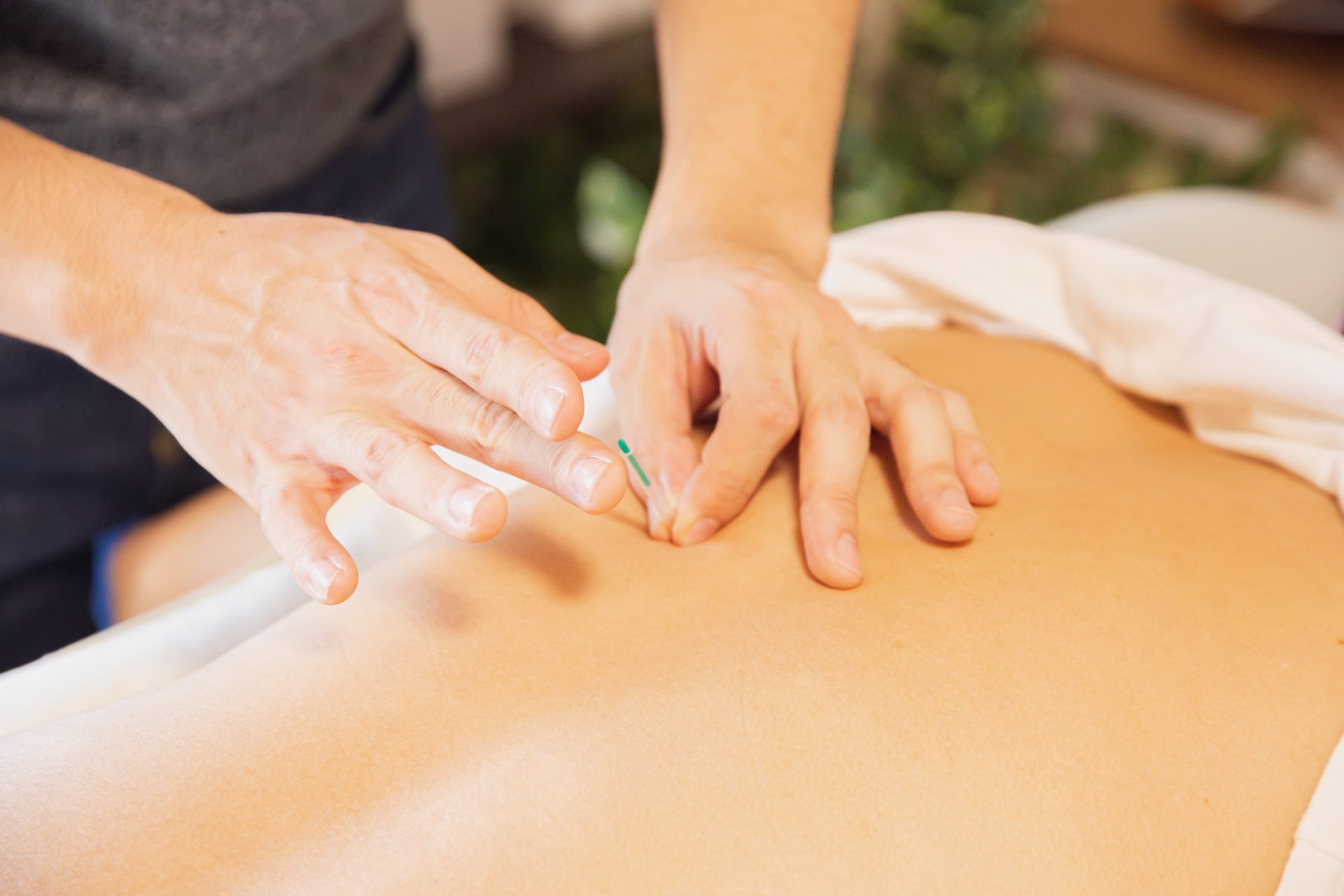 acupuncture in Markham