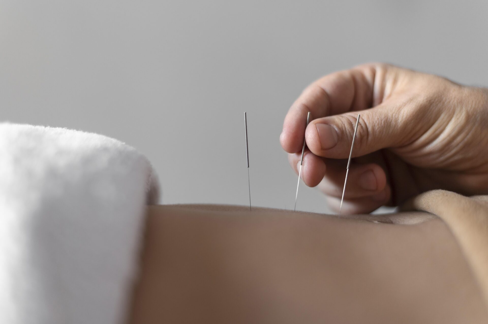 Fertility Acupuncture