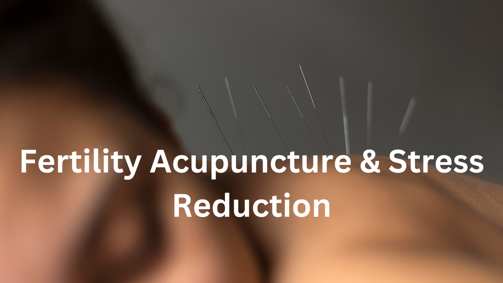 Fertility Acupuncture & Stress Reduction