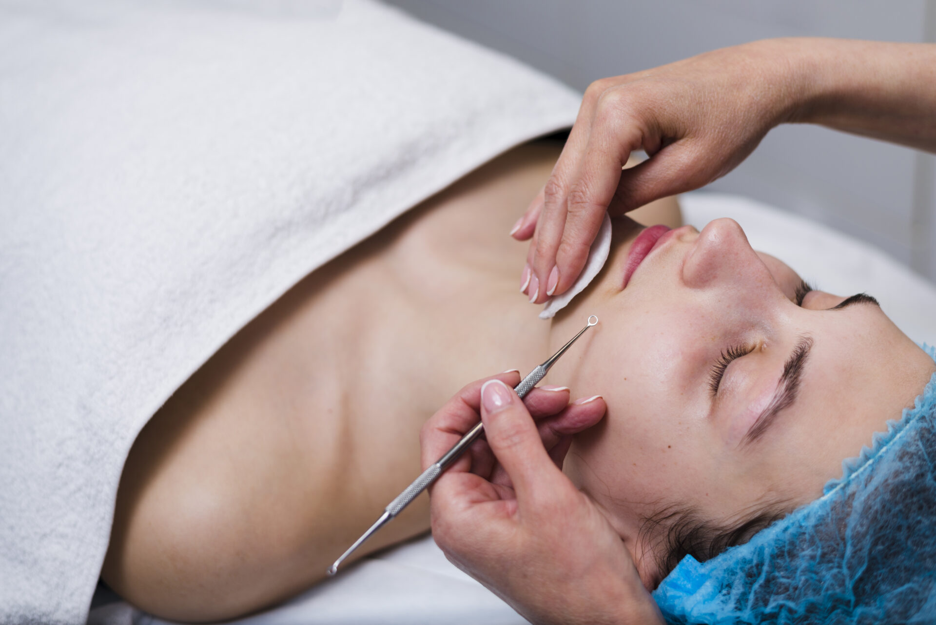 Cosmetic Acupuncture