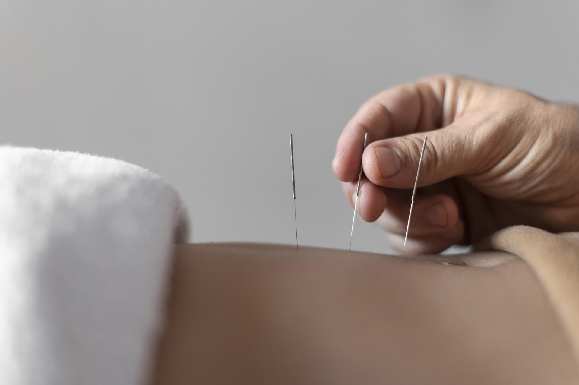 fertility acupuncture