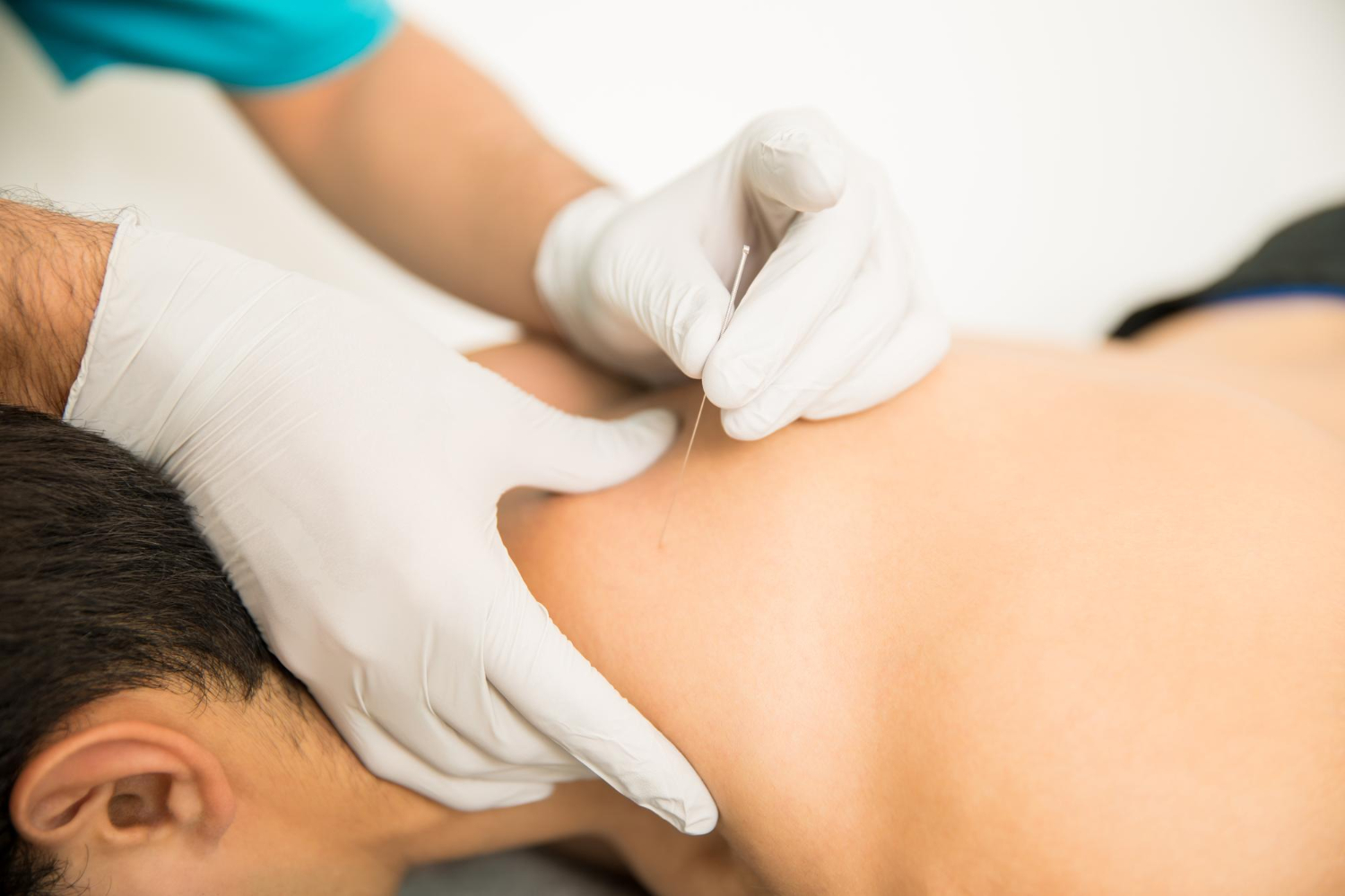 traditional Japanese acupuncture
